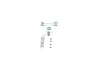 BOSCH LAND ROVER Установочный к-кт. торм. кол. Defender, Range Rover bosch 1987475301