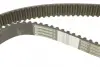 Комплект ременя грм Hepu PK05720 (фото 4)